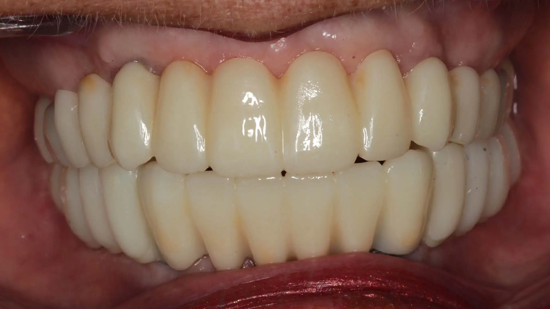 3a